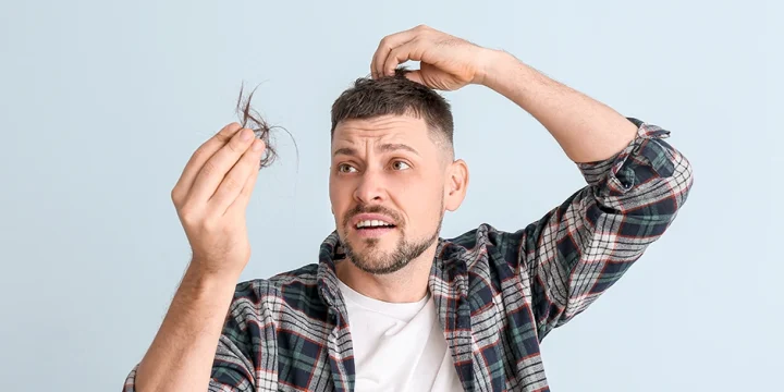 Man having hair loss from reduced testosterone